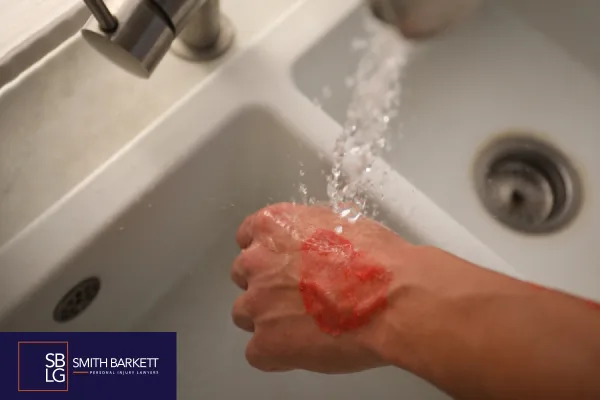 What Is a Burn Injury?