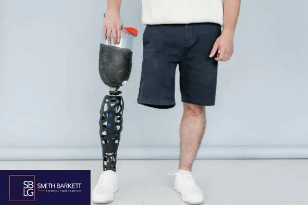What Is a Loss of Limb Injury?