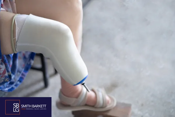 What Is an Amputation Injury?